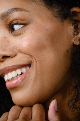 girl with freckles smiling and looking to the left